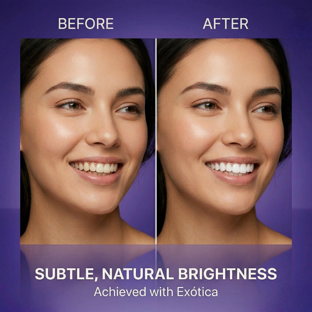 EXÓTICA Whitening Strips